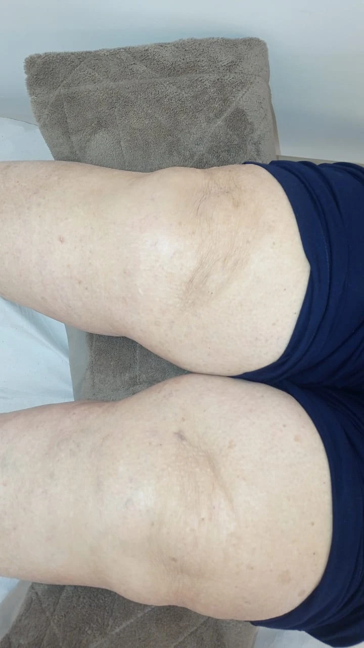 serviços,Método Acufisio,tratamentos estéticos,fisioterapia,acupuntura,medicina integrada,estética facial,redução de medidas,drenagem linfática,tratamento pós-cirúrgico,reabilitação ortopédica,ventosaterapia,RPG,acupuntura auricular,fisioterapia neurológica,fisioterapia respiratória,fisioterapia pélvica,incontinência urinária