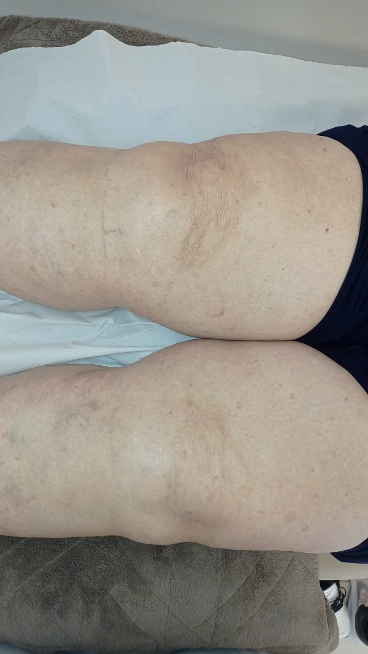 serviços,Método Acufisio,tratamentos estéticos,fisioterapia,acupuntura,medicina integrada,estética facial,redução de medidas,drenagem linfática,tratamento pós-cirúrgico,reabilitação ortopédica,ventosaterapia,RPG,acupuntura auricular,fisioterapia neurológica,fisioterapia respiratória,fisioterapia pélvica,incontinência urinária