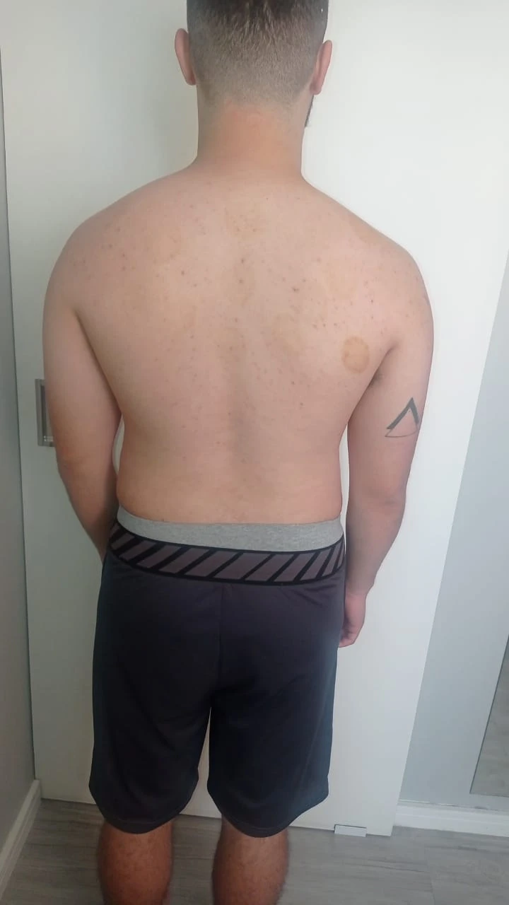 serviços,Método Acufisio,tratamentos estéticos,fisioterapia,acupuntura,medicina integrada,estética facial,redução de medidas,drenagem linfática,tratamento pós-cirúrgico,reabilitação ortopédica,ventosaterapia,RPG,acupuntura auricular,fisioterapia neurológica,fisioterapia respiratória,fisioterapia pélvica,incontinência urinária