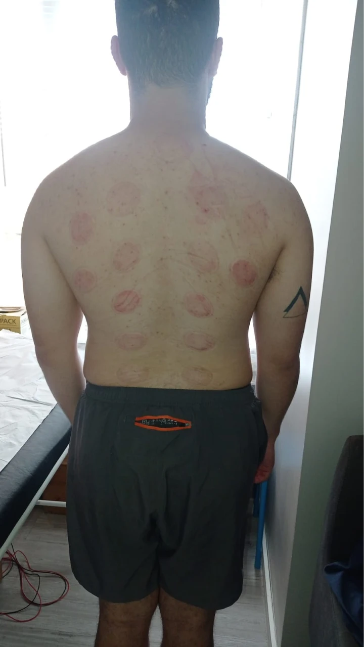 serviços,Método Acufisio,tratamentos estéticos,fisioterapia,acupuntura,medicina integrada,estética facial,redução de medidas,drenagem linfática,tratamento pós-cirúrgico,reabilitação ortopédica,ventosaterapia,RPG,acupuntura auricular,fisioterapia neurológica,fisioterapia respiratória,fisioterapia pélvica,incontinência urinária