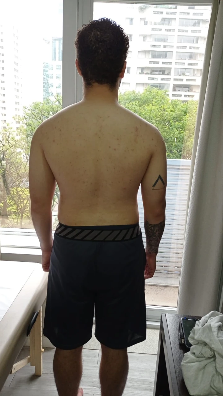 serviços,Método Acufisio,tratamentos estéticos,fisioterapia,acupuntura,medicina integrada,estética facial,redução de medidas,drenagem linfática,tratamento pós-cirúrgico,reabilitação ortopédica,ventosaterapia,RPG,acupuntura auricular,fisioterapia neurológica,fisioterapia respiratória,fisioterapia pélvica,incontinência urinária