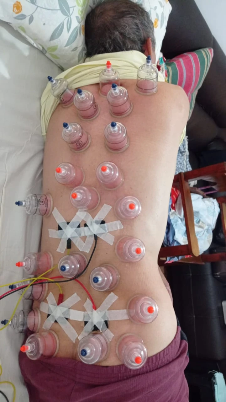 serviços,Método Acufisio,tratamentos estéticos,fisioterapia,acupuntura,medicina integrada,estética facial,redução de medidas,drenagem linfática,tratamento pós-cirúrgico,reabilitação ortopédica,ventosaterapia,RPG,acupuntura auricular,fisioterapia neurológica,fisioterapia respiratória,fisioterapia pélvica,incontinência urinária