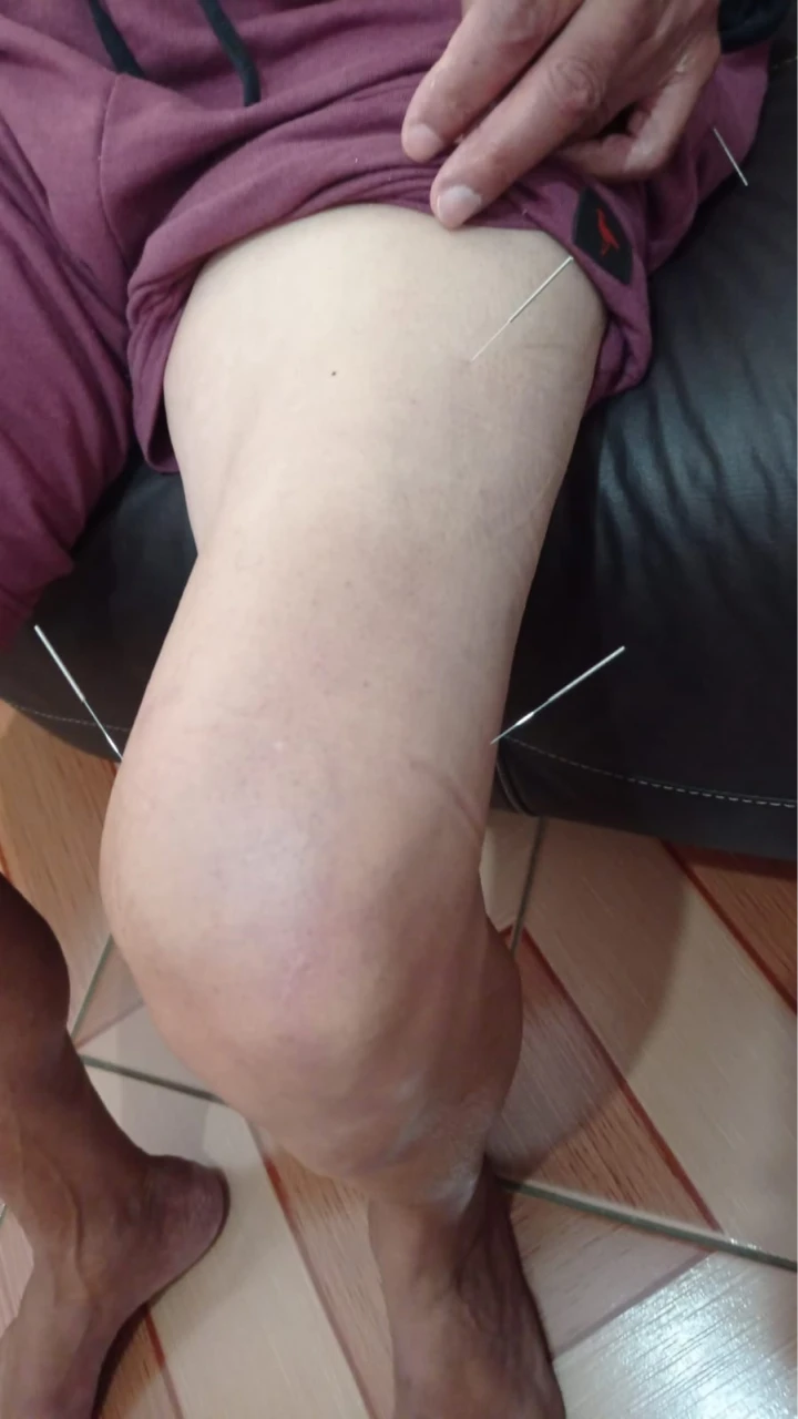 serviços,Método Acufisio,tratamentos estéticos,fisioterapia,acupuntura,medicina integrada,estética facial,redução de medidas,drenagem linfática,tratamento pós-cirúrgico,reabilitação ortopédica,ventosaterapia,RPG,acupuntura auricular,fisioterapia neurológica,fisioterapia respiratória,fisioterapia pélvica,incontinência urinária